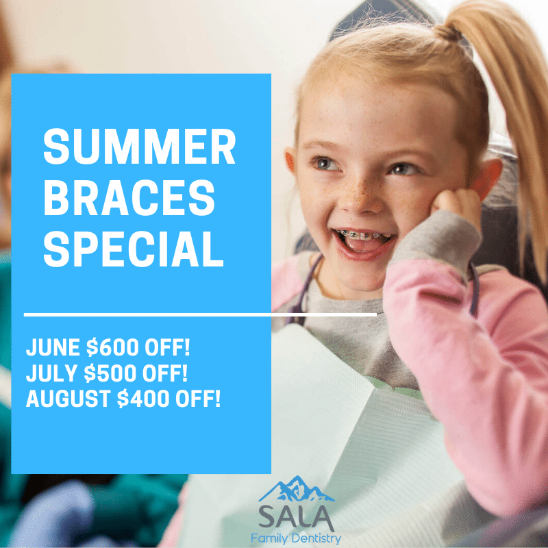 summer braces