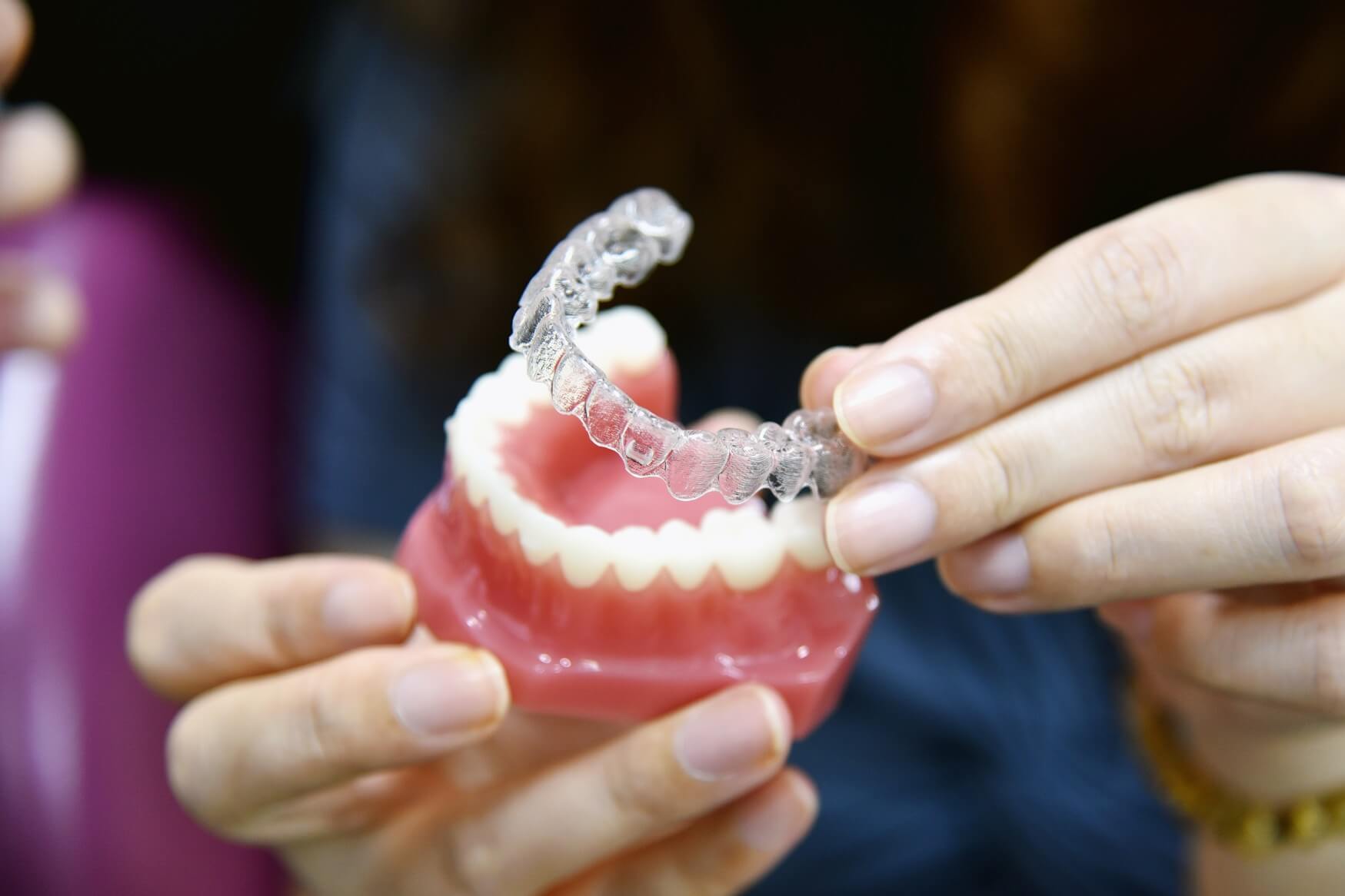 night guard on model of teeth