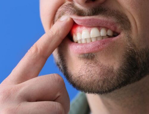 Understanding and Preventing Gum Disease During National Gum Disease Awareness Month