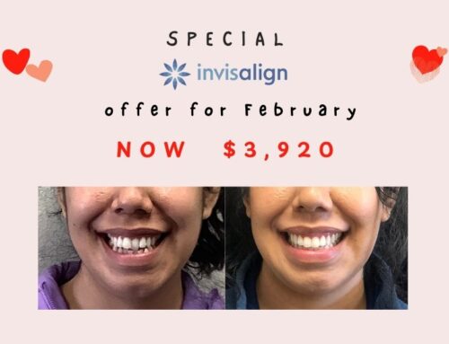 February Exclusive: Invisalign Savings + Free Botox & Whitening!